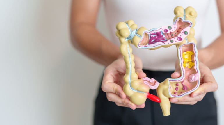 10 perguntas mais frequentes de pacientes recém-diagnosticados com Doenças Inflamatórias Intestinais